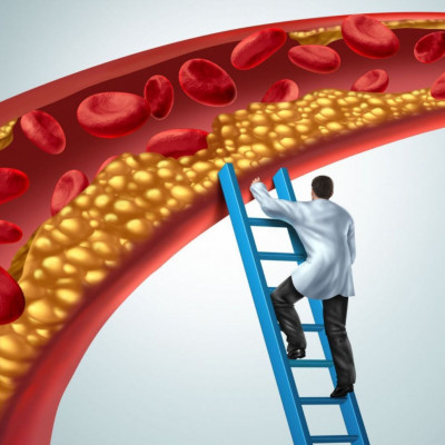 Τριγλυκερίδια: Τι πρέπει να αποφεύγετε για να τα μειώσετε (εικόνες)