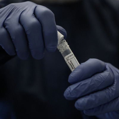 Μαγιορκίνης: Κατά 99% ο ιός της οξείας ηπατίτιδας βρίσκεται ήδη στην Ελλάδα