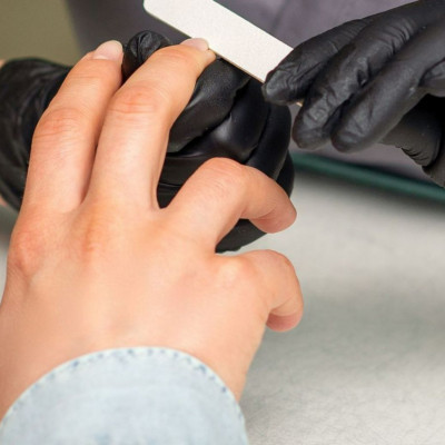 Υψηλή χοληστερόλη: Τα σημάδια στα νύχια που μπορεί να αποτελούν σύμπτωμα