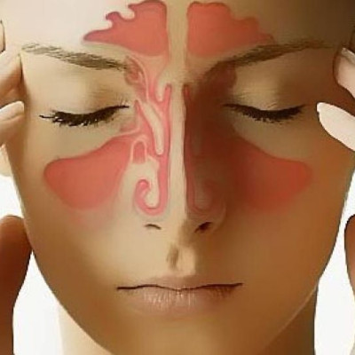 Η ιγμορίτιδα ταλαιπωρεί παιδιά και μεγάλους  - Πώς θα την αντιμετωπίσουμε