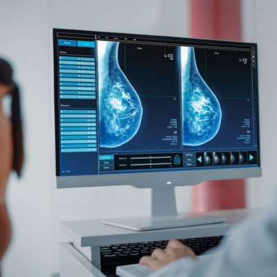 Τομοσύνθεση, η τεχνολογική εξέλιξη της ψηφιακής μαστογραφίας