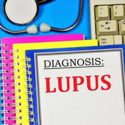 Παγκόσμια Ημέρα Λύκου: Τα συμπτώματα της νόσου που «χτυπά» τις γυναίκες (εικόνες)