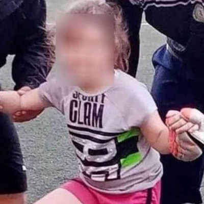 Τζωρτζίνα: Η κεταμίνη χορηγήθηκε ενδοφλέβια – Τι έδειξε η σύγκριση με 114 θανάτους από κεταμίνη