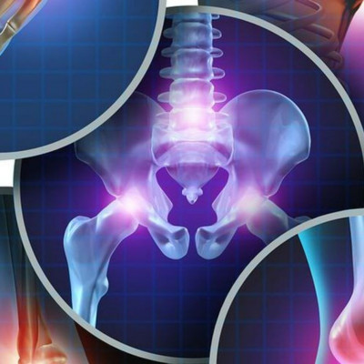 Αγκυλοποιητική σπονδυλίτιδα: Οι 4 παράγοντες κινδύνου για αυτόν τον τύπο νωτιαίας αρθρίτιδας