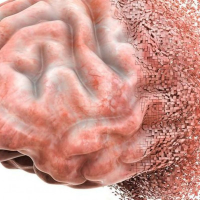 Πώς ο ανθρώπινος εγκέφαλος επεξεργάζεται και αποθηκεύει την κίνηση - μελέτη