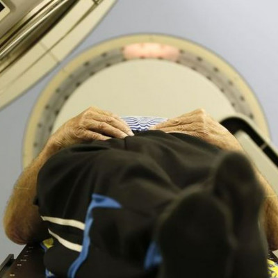 Η ενιαία μαγνητική τομογραφία διαγιγνώσκει τη μελέτη Αλτσχάιμερ πρώιμου και προχωρημένου σταδίου