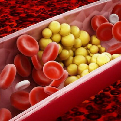 Το αίμα είναι πιο παχύρρευστο από το νερό και μπορεί να προβλέψει τον κίνδυνο θανάτου από Covid-19