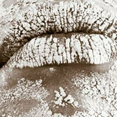 Τι είναι η ιχθύωση τύπου αρλεκίνου, η παράξενη ασθένεια του «δέρματος των ψαριών»;