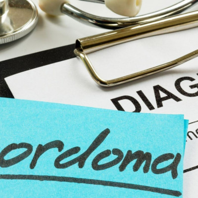 Χόρδωμα: Τα συμπτώματα, η διάγνωση και η θεραπεία