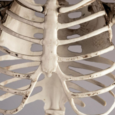 Σπασμένο πλευρό: Τα συμπτώματα και οι λόγοι να επισκεφτείτε έναν γιατρό