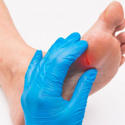 Διαβητικά έλκη: Πώς θα τα προλάβετε