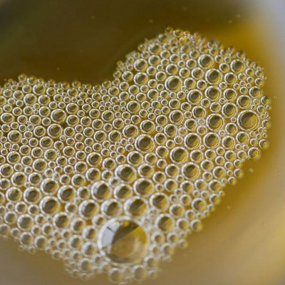 Αφρώδη ούρα: Οι παθολογικές αιτίες, τα συμπτώματα & οι λόγοι που θα σας οδηγήσουν στον γιατρό