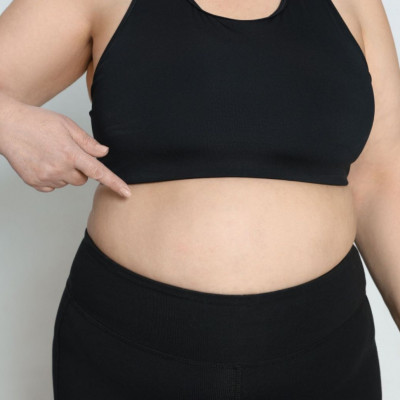 Βαριατρική: Πόσο μειώνει τον κίνδυνο εμφράγματος & εγκεφαλικού