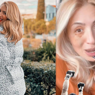 Ηλιάκη: Με μελανιασμένο μάτι από την κόρη της: «Μεγαλώνω τον Ρόκυ»