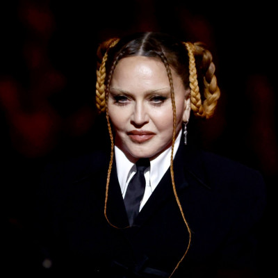 Η Madonna απαντά για τις πλαστικές και το πρήξιμο από το χειρουργείο