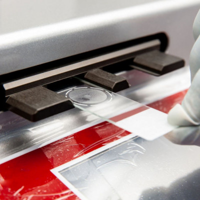 Καρκίνος τραχήλου της μήτρας: Το τεστ που τον εντοπίζει χρόνια πριν