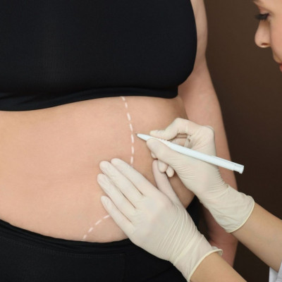 Βαριατρική: Τα σημαντικά οφέλη για την υγεία πλην της απώλειας βάρους