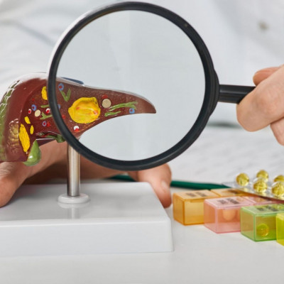 Λιπώδης διήθηση: Τι περιλαμβάνει η διατροφή για την αντιμετώπισή της