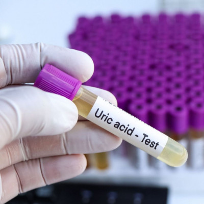 Υψηλό ουρικό οξύ: Τι προκαλεί στον εγκέφαλο