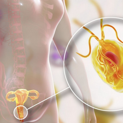 Το κοινό ΣΜΝ που πολλαπλασιάζει τον κίνδυνο καρκίνου του τραχήλου