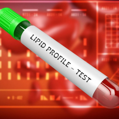 Χοληστερίνη και τριγλυκερίδια: Πότε αυξάνουν τον κίνδυνο άνοιας