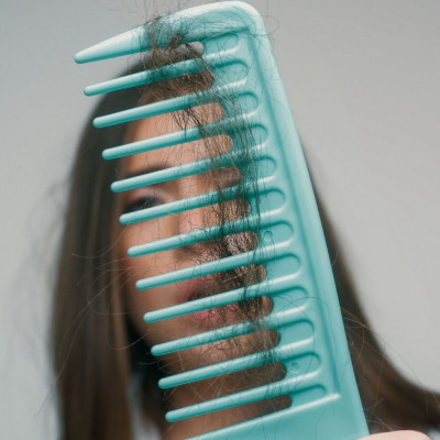 Τριχόπτωση: Οι αιτίες και οι βιταμίνες που την προλαμβάνουν