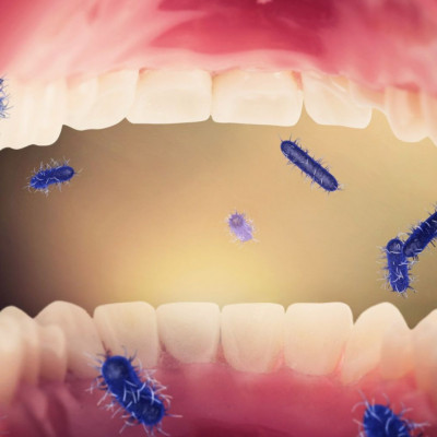 Νόσος του Crohn: Πώς συνδέεται με τα βακτήρια του στόματος