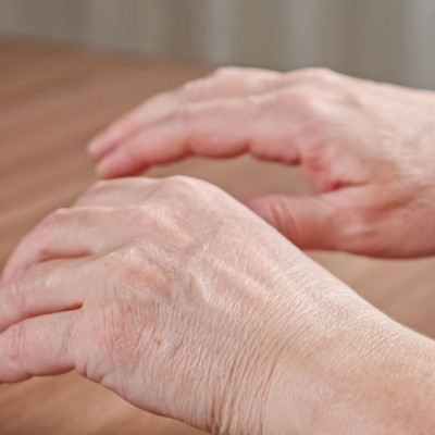 Το παράδοξο σημάδι καρκίνου που εμφανίζεται στα χέρια και στα πόδια