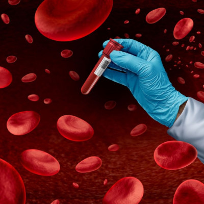 Καρκίνος αίματος: Η επέμβαση που μειώνει τον κίνδυνο για τις γυναίκες