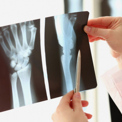 Αρθρίτιδα χεριών: Τι είναι καλύτερο για την αντιμετώπιση του πόνου