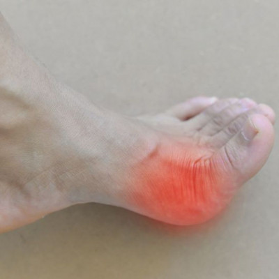 Ουρική αρθρίτιδα: Πόσο αυξάνει τον κίνδυνο χρόνιας νεφρικής νόσου