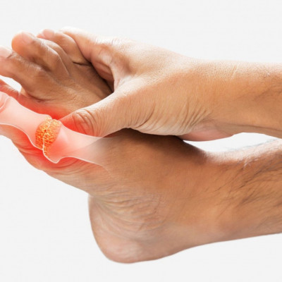 Ποιες αρθρώσεις προσβάλλει η ουρική αρθρίτιδα