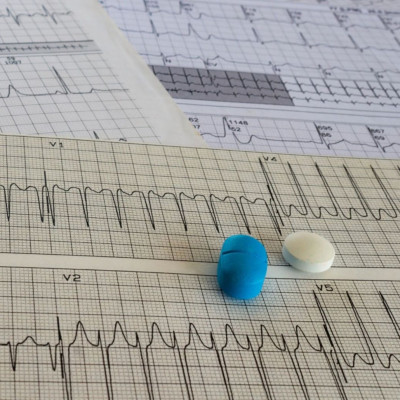 Κολπική μαρμαρυγή και εγκεφαλικό: Πώς θα τα αποφύγετε