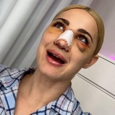 Σχόλιο που έκαναν στην Τούνη μετά την επέμβαση στη μύτη δείχνει γιατί το γυναικείο κοινό τη λατρεύει