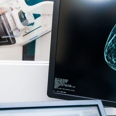 Απεικόνιση Μαστού – Δώρο ζωής για τις γυναίκες