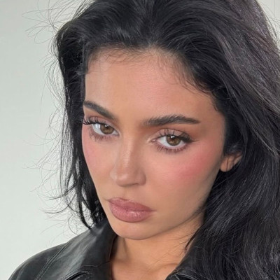 Δοκίμασες lip filler; Η δερματολόγος μοιράζεται μαζί μας όσα δεν πρέπει να κάνεις μετά