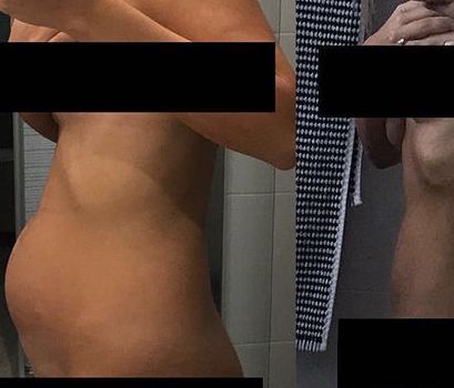 Κάπως έτσι μοιάζει η ενδομητρίωση για όσους δεν γνωρίζουν