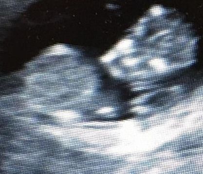 Πριν μια ώρα ανακοίνωσε τα ευχάριστα νέα! Θα γίνει μπαμπάς για δεύτερη φορά