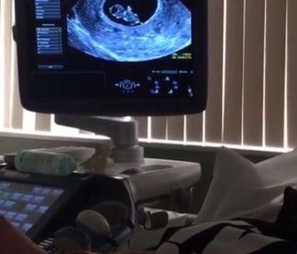Θα γίνουν γονείς: Δημοσίευσαν για πρώτη φορά βίντεο με το υπερηχογράφημα του μωρού στο Instagram