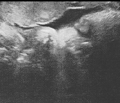 Για πρώτη φορά, μας δείχνουν το υπερηχογράφημα του μωρού που περιμένουν