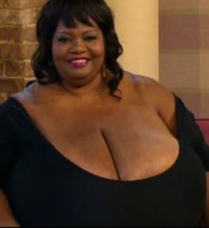 Η γυναίκα με το μεγαλύτερο στήθος στον κόσμο!