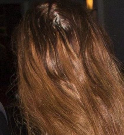 Η φωτογραφία που κάνει το γύρο του κόσμου: Ποια σταρ χάνει τα μαλλιά της;