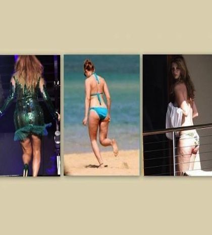 Έχουν και αυτές ατέλειες!