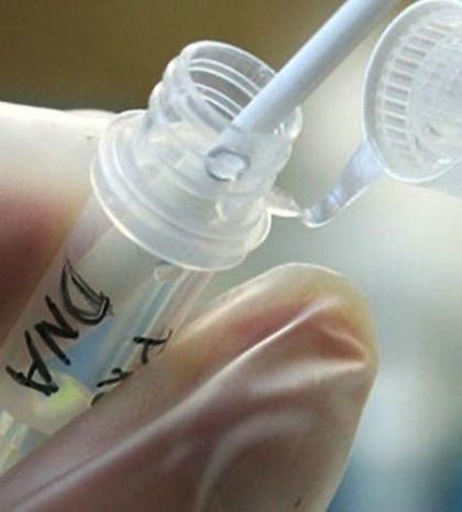 Πάρος: Τα τεστ DNA θα δώσουν τις απαντήσεις για τον «δράκο»