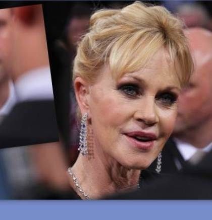 Το πρόσωπό της Melanie Griffith, που σοκάρει!