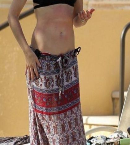 «Τσουρουφλίστηκε» γνωστή τραγουδίστρια! (φωτό)