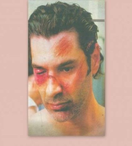 Ποιος έσπασε στο ξύλο τον Χριστόφορο Παπακαλιάτη;