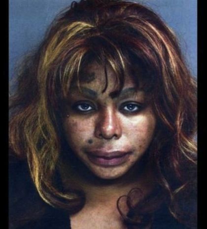 Του έκανε ένεση σιλικόνης στο πέος του και εκείνος πέθανε