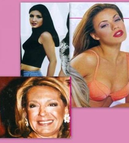 Δείτε το πριν και το μετά των Ελληνίδων που έκαναν πλαστική