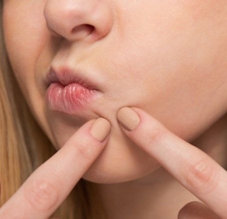 Σπυράκια με πύον: Τι τα προκαλεί και πώς θα τα αντιμετωπίσετε